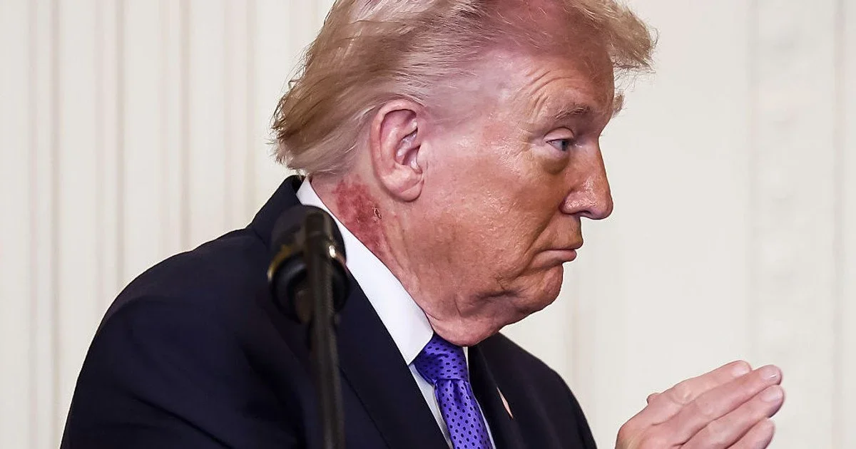 Дональд Трамп висловився щодо відсутності зобов’язань США перед Україною