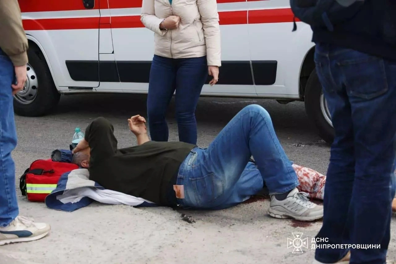 Медики Дніпра продовжують боротьбу за здоров’я сімох поранених внаслідок ворожого обстрілу 14 квітня